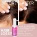 Remixidil Minoxidil 2% Hair Growth Spray for Women - Thinning Hair Regrowth & Thickening Treatment | Fast International Shipping - Buy Online on GoSupps.com