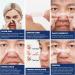 80 Pcs Anti-Snoring Plasters | Better Breathing Aid for Sleep & Sports | Nose Paving Solution to Stop Snoring - Buy Online on GoSupps.com