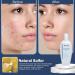 JOESOEF SKIN CARE Anti-Acne Lotion Sulfur 6.6% for Prone Skin- Acne Pharmaceutical Grade Dermatologists Approved for Acne Rosacea. Sulfur Acne Treatment for Skin Care Daily Routine 100ML - Buy Online on GoSupps.com