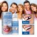 Provisional Denture Adhesive Set | Temporary Dental Repair Kit & Instant Veneers for Provisional Teeth - Buy Online on GoSupps.com