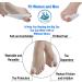 Bunion Corrector and Hallux Valgus Pain Relief Kit - Orthopedic Toe Straightener for Women Men - 11 Pack - Buy Online on GoSupps.com
