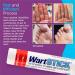 WartStick Maximum Strength Salicylic Acid Solid-Stick Wart Remover 0.2 Oz - Buy Online on GoSupps.com