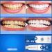 Prediotics Whitening Toothpaste with Probiotics - SP-Y6 for Healthy Teeth & Gums (1pc) - Best International Shipping - Buy Online on GoSupps.com