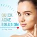 Hydrocolloid Acne Patches (120 Pack) with Tea Tree Oil - Pimple Stickers for Healing Acne - Zit Patch Treatment - Buy Online on GoSupps.com