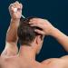 Roman Minoxidil 5% Hair Loss Treatment | Unscented Solution for Thinning Hair | 1-Month Supply - Buy Online on GoSupps.com