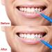 100 Interdental Brushes - Oral Hygiene Tooth Cleaning Tool - Red Blue Green Light Blue | International Shipping Available - Buy Online on GoSupps.com