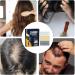 Croissance des cheveux - Solution du cuir chevelu - Formule de soutien folliculaire pour l'amincissement - Soin des d mangeaisons avec extraits botaniques - Cat gorie de soins capillaires 20 pi ces. - Buy Online on GoSupps.com