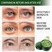 60PCS Green Avocado Eye Pads | Anti-Aging Hydrating Hydrogel Masks for Dark Circles Puffiness & Tear Bags - Buy Online on GoSupps.com