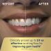 Waterpik Cordless Advanced Water Flosser - ADA Accepted, Rechargeable & Portable - White WP-560 - Buy Online on GoSupps.com