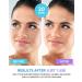 MAREE Pearl Eye Masks & Facial Masks - Natural Marine Collagen Hyaluronic Acid Anti-Aging Treatment - Reduces Wrinkles, Puffy Eyes, Dark Circles, Dry Skin - 12 Eye Masks, 6 Face Masks - Buy Online on GoSupps.com