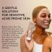 BOLDEN Clear Skin Clay Mask with Sulfur | Deep Pore Cleansing Breakout Prevention & Oil Reduction | Best for Sensitive Skin | 3.5 fl oz - Buy Online on GoSupps.com
