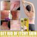 Inalsion Revitaskin Eczema Cure Cream - Eczema & Psoriasis Treatment Relief for Adults (3pcs) - Buy Online on GoSupps.com