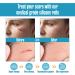 Houseables Silicone Scar Sheets Gel Tape 1.57 x 60 - Tan, Flexible Medical Grade for Surgery, Keloids, Burns - Sensitive Skin, Wound Protection - Healing Gel Patch - Buy Online on GoSupps.com