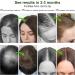 S rum Pousse Cheveux Naturel Soin Intensif pour Cheveux Clairsem s S rum Pousse Cheveux pour Hommes et Femmes Renforce les Racines Am liore la Densit Soin des Cheveux Quotidien Vert - Buy Online on GoSupps.com