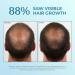 Bosley Men's Hair Re-growth Treatment | 5% Minoxidil Topical Solution - Buy Online on GoSupps.com