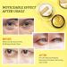 LIYALAN Gold Under Eye Patches - Dark Circle & Puffiness Treatment - Buy Online on GoSupps.com