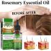 Rosemary Essential Oil For Hair Strenghten And Anti-Hair Loss Rosemary Hair Oil Hair Growth Oil Pure & Natural Nourishes Scalp Stimulates Hair Growth Lmprove Blood Circulation Vegan - Buy Online on GoSupps.com