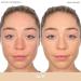 Almay Clear Complexion Acne Foundation Makeup - Lightweight Medium Coverage with Salicylic Acid - Hypoallergenic, Fragrance-Free for Sensitive Skin - 200 Buff, 1 fl oz - Buy Online on GoSupps.com