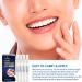 Soniultra Teeth Whitening Pen - 4 Pcs, 70+ Uses, Whiter Teeth in 1 Week - Buy Online on GoSupps.com