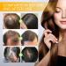 Luxury Biotin Hair Growth Serum - Premium 3pcs Set for Enhanced Hair Growth - Buy Online on GoSupps.com