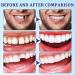 Tooth Glue & Repair Kit | DIY Dentures & Fillings | Best Tooth Bonding Solutions - Buy Online on GoSupps.com