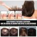 S rum de Croissance de Cheveux Serum Pousse Cheveux Serum Cheveux Pousse Rapide Liquide de Croissance des Cheveux Anti Chute Cheveux Traitements Pour la Repousse des Cheveux - Buy Online on GoSupps.com