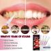 MYPROKIT Teeth Whitening Kit - 4 Packs, 120+ Uses, Pen & Gel, No Sensitivity, Stain Remover - Includes Shade Guide for Daily Use - Buy Online on GoSupps.com