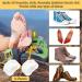 Metatarsal Pads (6 Pack) for Women and Men - Foot Cushions for Mortons Neuroma Relief and Arch Support - Buy Online on GoSupps.com