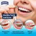 ProPicks MicroPick Dental Picks - Disposable Plastic Toothpicks for Teeth & Gums Cleaning | 720 Count | With Zinc Oxide | International Shipping Available - Buy Online on GoSupps.com