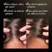FAQ 301 Scalp Massager & Scalp Recovery & Probiotic Hair Serum Bundle Head Massager for Hair Growth with Centella & Red Clover Serum for Thicker Stronger Hairline 60 ml - Buy Online on GoSupps.com
