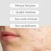 Skin & Out - Patchs Micro-aiguilles x9 - Stop boutons - Traitement des boutons - R duction rapide de l'inflamation sous-cutan e - Actifs anti-inflammatoires - Microkystes - Yuka 93/100 - Vegan - Buy Online on GoSupps.com