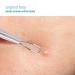Trim Beautycare Skin Care Tool 02669 - 1 Count | Shop Internationally for Perfect Skin Care Solutions - Buy Online on GoSupps.com