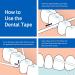 TePe Dental Band Wide - Waxed & Embossed for Effortless Oral Hygiene | 40m Pack - Shop Internationally - Buy Online on GoSupps.com