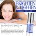 Dermalex-MD Under Eye Serum - Dark Circle Remover with Collagen Peptides - Reduce Puffiness, Sagging & Discoloration - Anti Aging Formula (1.25 oz) - Buy Online on GoSupps.com