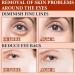 Moisturizing Eye Cream for Dark Circles & Puffiness - Anti-Aging Treatment for Fine Lines & Wrinkles - Buy Online on GoSupps.com