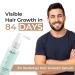 Buy mars by GHC Hair Growth Serum - Advanced 3% Redensyl & Procapil Biotin & Saw Palmetto for Effective Hair Regrowth & Thinning Control (60ml) - International Shipping Available - Buy Online on GoSupps.com