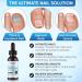 Ingrown Toenail Treatment Kit - Complete 3 in 1 Removal & Pain Relief - 100% Natural Drops Clippers & Nail Lifter - Shop Internationally - Buy Online on GoSupps.com