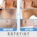 ESTETIST Skin Brightener Gel: Dark Spot Remover for Body, Face, Bikini & Sensitive Areas - Buy Online on GoSupps.com
