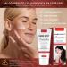 Dark Spot Remover for Face and Body Freckle Removel Cream Pigmentation Removal Melasma Cream Dark Spot Corrector Dark Spot Remover for Face Age Spot Remover for Face Dark Age Spot Remover - Buy Online on GoSupps.com