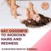Bella Donna Blush Pink Wax Pearls 1000g - Stripless & Painless Hair Removal Beads - Buy Online on GoSupps.com