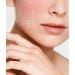 Sebamed Anti-Redness Gentle Cleansing Foam for Rosacea - 150 ml | Effective Facial Care to Reduce Redness - Buy Online on GoSupps.com