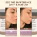 BELLA LIZ Eczema Cream 8oz - Soothing Relief for Dry Irritated Skin Hydrating & Healing Formula All-Natural Ingredients Perfect for Sensitive Skin & Daily Moisturizing - Buy Online on GoSupps.com
