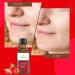 Strawberry Seed Oil - 100% Natural Cold Pressed Carrier Oil for Skin, Hair, Face, Lip, and Nails Care - Aromatherapy & Massage Oil - Essential Oil for Yoga, Sleep, Diffuser - 3.4 Oz - Buy Online on GoSupps.com