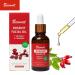Rosehip Vitamin C Face Oil with Turmeric - 100% Natural Hydrating & Brightening Facial Oil | Cold Pressed Rosehip Oil 1oz/30ml - Buy Online on GoSupps.com