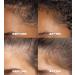 XMONDO Hair A3 Complex Scalp Foam for Hair Density | Vegan Formula with Biollagen & Amaranth Fast-Acting Plant Actives For Amplified Volume & Visibly Fuller Healthier-Looking Hair 3.38 Fl Oz - Buy Online on GoSupps.com