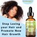 Botanical Beauty Organic Castor Oil 100% Pure Natural Cold Pressed Carrier Oil 1 Fl.oz.- 30 ml. for Face Skin Hair Lashes Brows Nails. - Buy Online on GoSupps.com