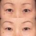 Instant Effects Eye Lift Serum: Repair, Smooth, and Moisturize - Diminish Dark Circles and Puffiness - Brighten, Lift, and Nourish - 0.27 Oz - Buy Online on GoSupps.com