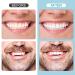 Tooth Repair Kit for Crowns & Bridges Filling - 6PCS | Enhance Your Smile with Easy DIY Solutions - Buy Online on GoSupps.com