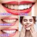 Shop V34 Purple Toothpaste for Teeth Whitening - Color Corrector Serum for Adults | Effective Stain Removal & Brightening - Buy Online on GoSupps.com
