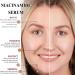 5% Niacinamide Face Serum Dark Spot Correcting Glow Serum Day & Night Serum for Dry &Sensitive Skin Balanced Grease Pore Contraction -Fade Acne Marks Facial Serum Anti Aging Face Cream Skin Repair - Buy Online on GoSupps.com